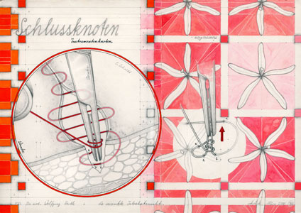 Zeichnung 'Versenkte Intrakutannaht, 5. Schritt', 2005